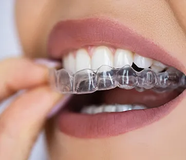 invisalign Legacy Dental Care Home