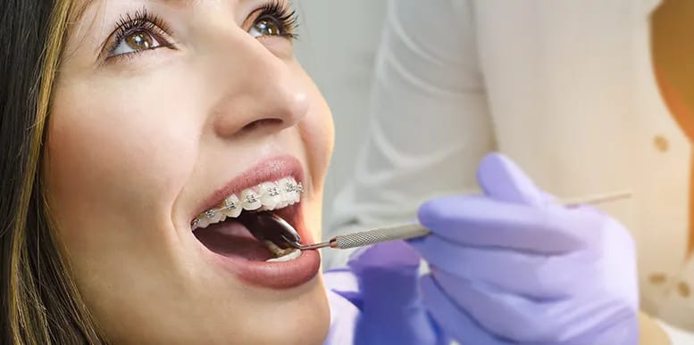 braces service 2 Legacy Dental Care Braces