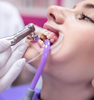scale polish Legacy Dental Care Home